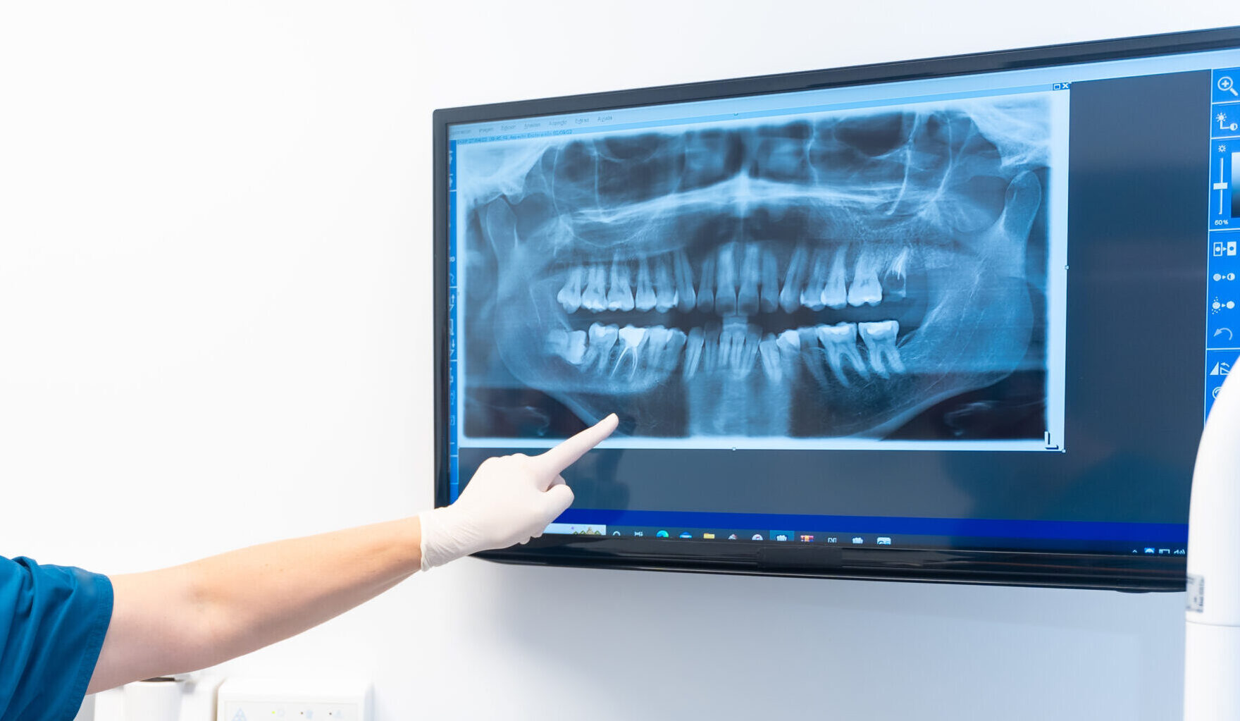 Dentist points to x-ray while explaining to a patient