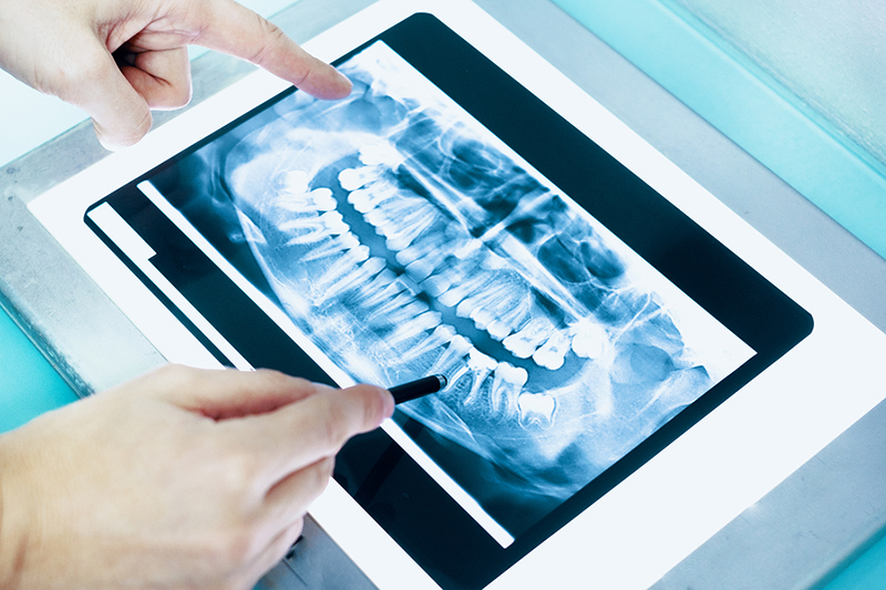 Hands point to specific teeth on a digital X-Ray on a tablet
